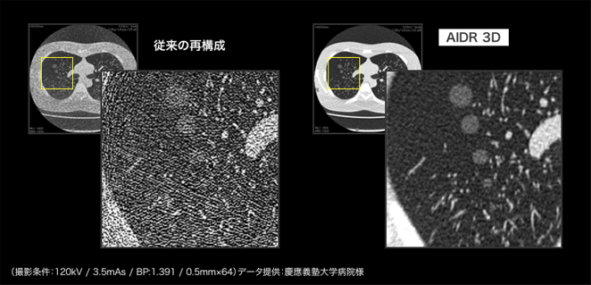 CT解析イメージ写真